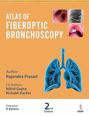 Atlas of Fiberoptic Bronchoscopy, 2e