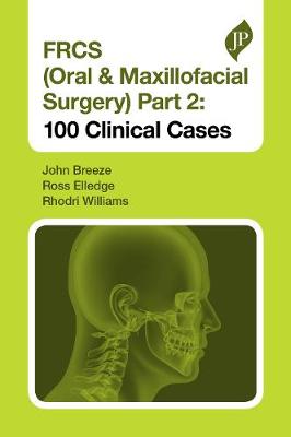 FRCS (Oral & Maxillofacial Surgery) Part 2: 100 Clinical Cases | ABC Books