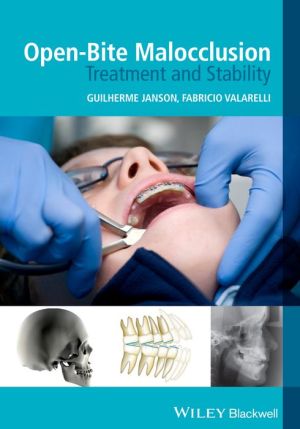 Open-Bite Malocclusion - Treatment and Stability