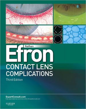 Contact Lens Complications, 3e ** | ABC Books