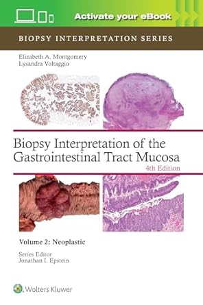 Biopsy Interpretation of the Gastrointestinal Tract Mucosa : Volume 2 Neoplastic: Print + eBook with Multimedia, 4e