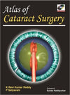 Atlas of Cataract Surgery