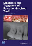Diagnosis and Treatment of Furcation-Involved Teeth