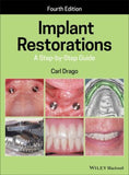Implant Restorations: A Step-by-Step Guide, 4e