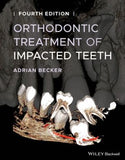 Orthodontic Treatment of Impacted Teeth, 4e