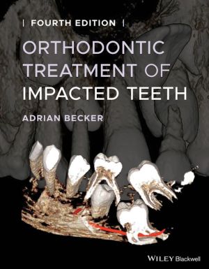 Orthodontic Treatment of Impacted Teeth, 4e