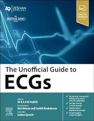 The Unofficial Guide to ECGs