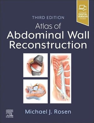 Atlas of Abdominal Wall Reconstruction, 3e