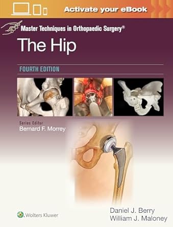Master Techniques in Orthopaedic Surgery: The Hip: Print + eBook with Multimedia, 4e | Daniel John Berry