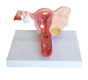 Reproductive Model-Bilateral Ovarian uterus-Ningbo (CM):00x00x00