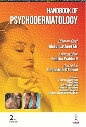 Handbook of Psychodermatology, 2e