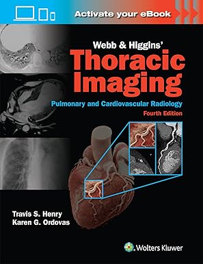 Webb & Higgins Thoracic Imaging: Print + eBook with Multimedia, 4e