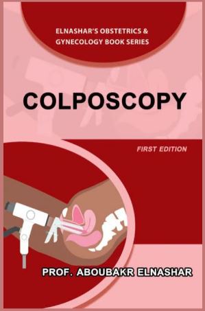 Colposcopy
