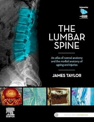 The Lumbar Spine : An Atlas of Normal Anatomy and the Morbid Anatomy of Ageing and Injury