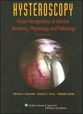 Hysteroscopy: Visual Perspectives of Uterine Anatomy, Physiology, and Pathology, 3e **
