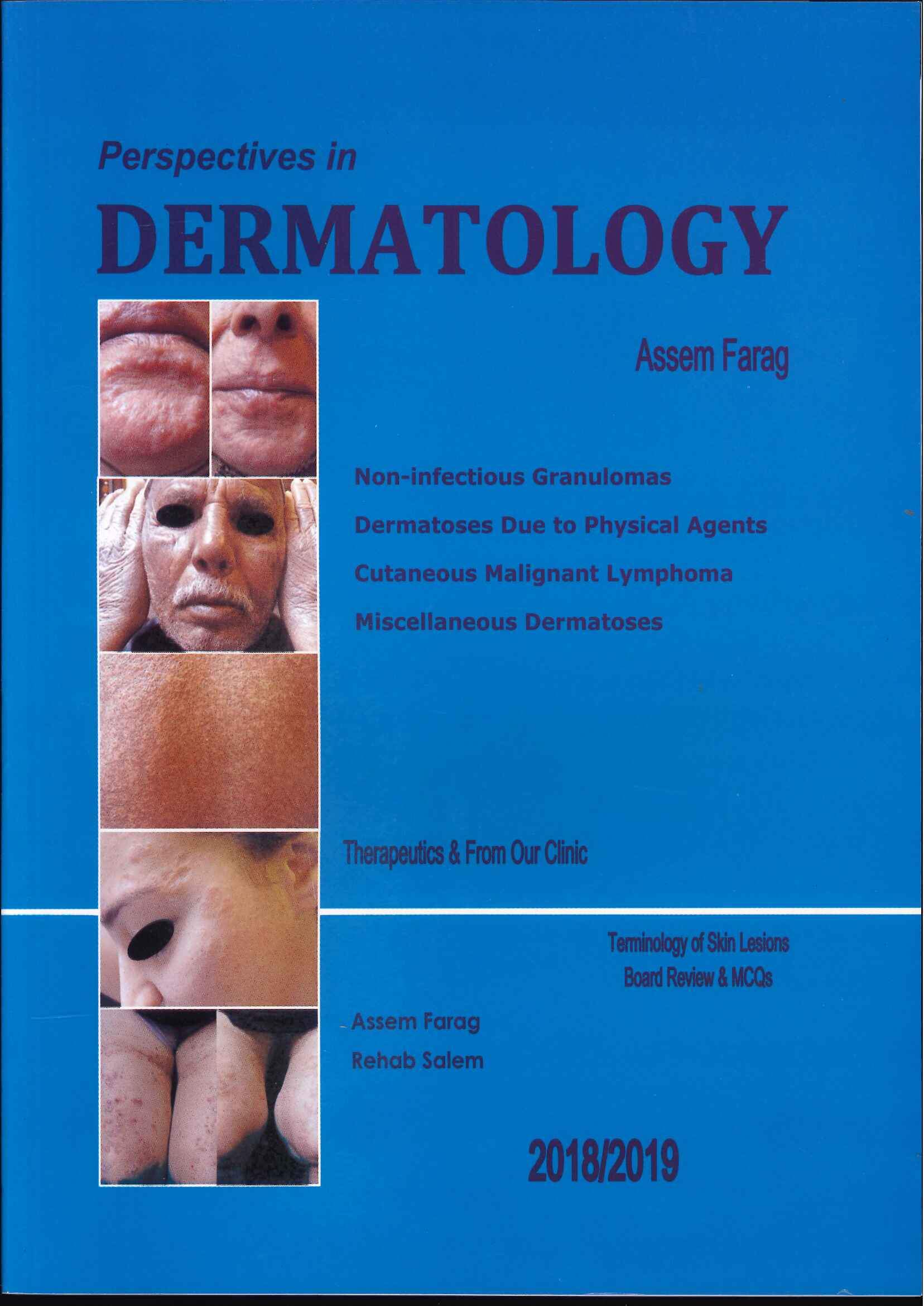 Perspectives in Dermatology : Non-infectious Granulomas Dermatoses Due to Physical Agents Cutaneous Malignant Lymphoma Miscellaneous Dermatoses Perspectives in Dermatology : Non-infectious Granulomas Dermatoses Due to Physical Agents Cutaneous Malignant Lymphoma Miscellaneous Dermatoses