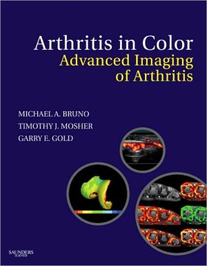 Arthritis in Color: Advanced Imaging of Arthritis ** Arthritis in Color: Advanced Imaging of Arthritis **