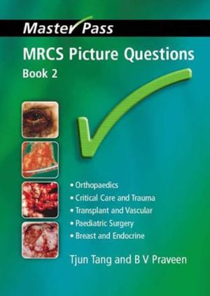 MasterPass: MRCS Picture Questions Book 2 MasterPass: MRCS Picture Questions Book 2