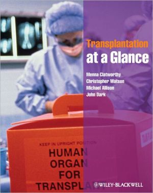 Transplantation at a Glance