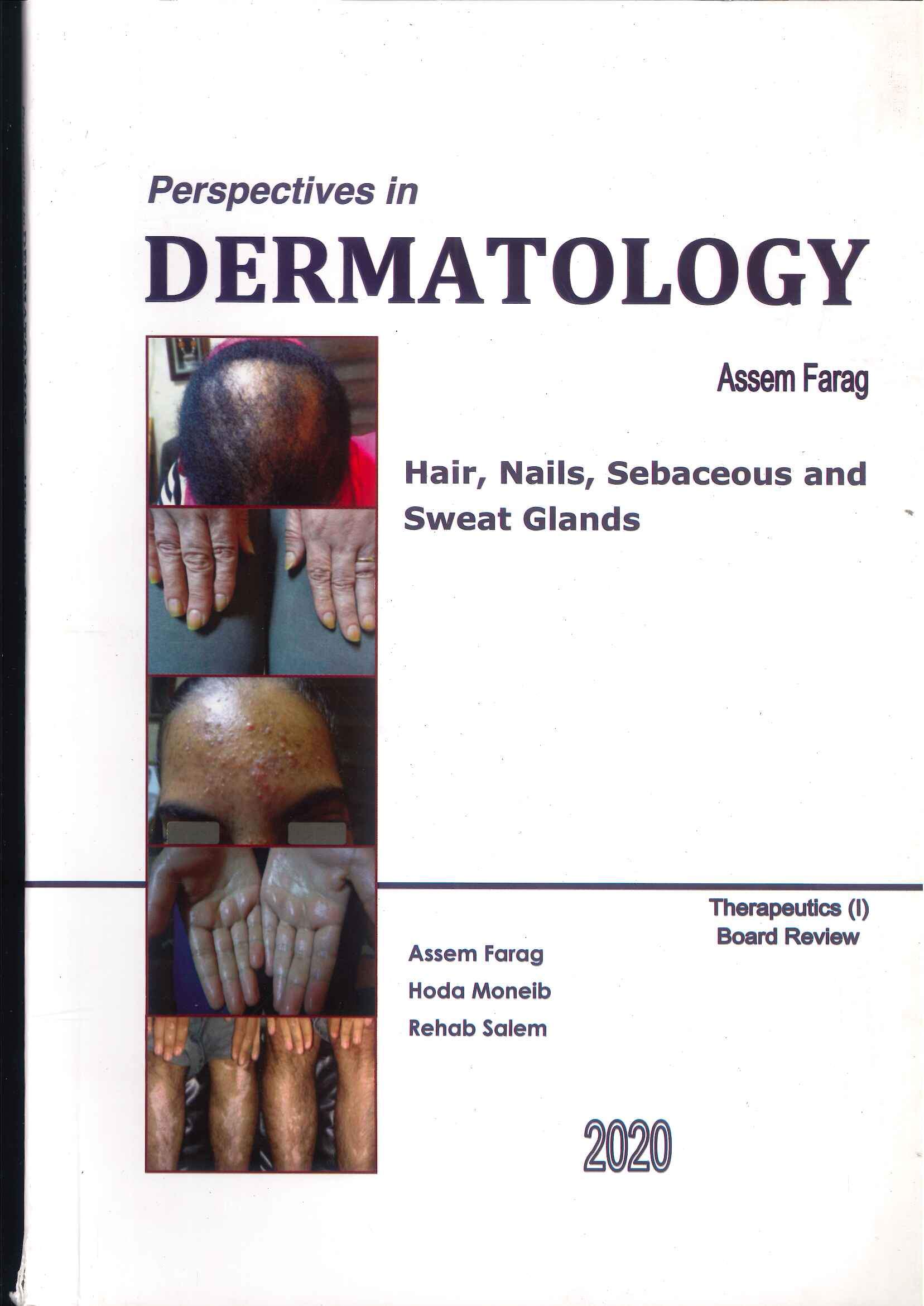 Perspectives in Dermatology : Hairs, Nails, Sebaceous and Sweat Glands Perspectives in Dermatology : Hairs, Nails, Sebaceous and Sweat Glands