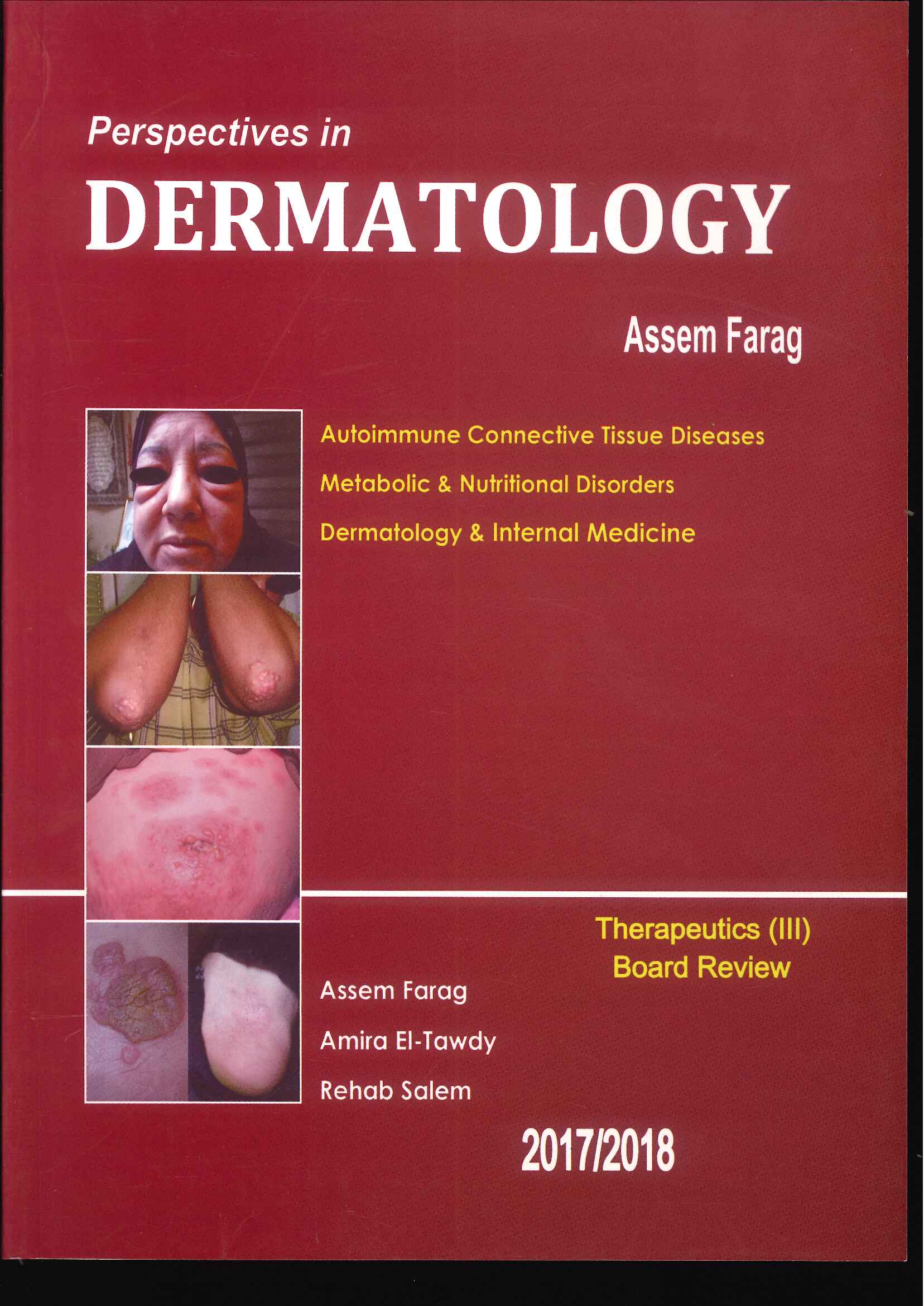 Perspectives in Dermatology : Autoimmune Connective Tissue Diseases Metabolic & Nutritional Disorders Dermatology & Internal Medicine Perspectives in Dermatology : Autoimmune Connective Tissue Diseases Metabolic & Nutritional Disorders Dermatology & Internal Medicine