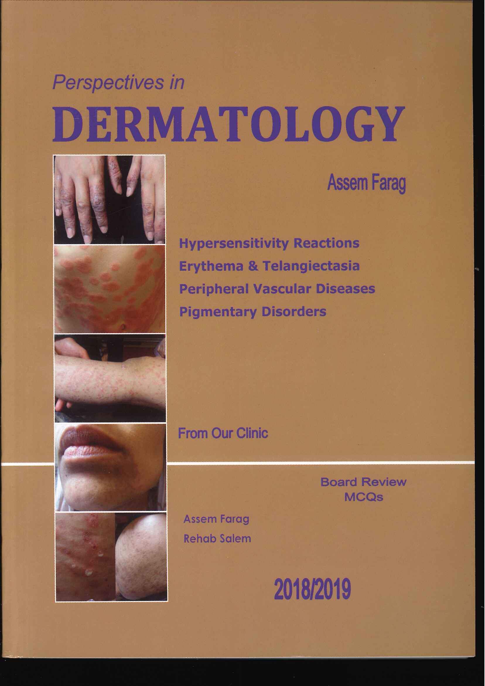 Perspectives in Dermatology : Hypersensitivity Reactions Erythema & Telangiectasia Peripheral Vascular Diseases Pigmentary Disorders Perspectives in Dermatology : Hypersensitivity Reactions Erythema & Telangiectasia Peripheral Vascular Diseases Pigmentary Disorders
