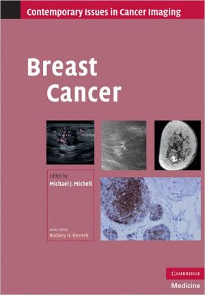 Breast Cancer | ABC Books