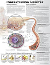 Understanding Diabetes Anatomical Chart, 3e | ABC Books