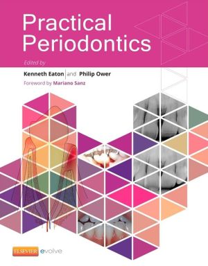 Practical Periodontics