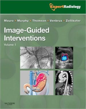 Image-Guided Intervention, 2-Volume Set **