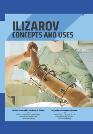 DR. Massoud Notes : Ilizarov - Concepts and Uses | ABC Books