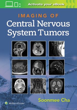 Imaging of CNS Tumors | ABC Books
