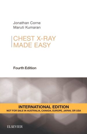 Chest X-Ray Made Easy (IE), 4e**