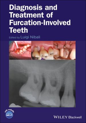 Diagnosis and Treatment of Furcation-Involved Teeth