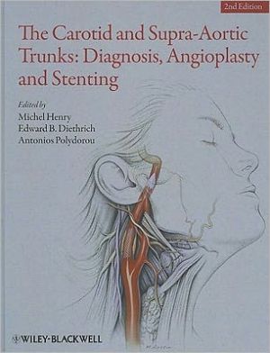 The Carotid and Supra-Aortic Trunks: Diagnosis, Angioplasty and Stenting