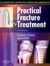 Practical Fracture Treatment (IE), 5e