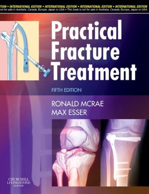 Practical Fracture Treatment 5e