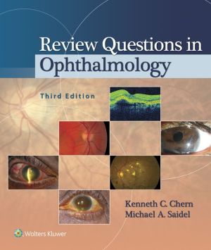 Review Questions in Ophthalmology, 3e | ABC Books