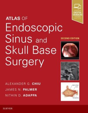 Atlas of Endoscopic Sinus and Skull Base Surgery, 2e | Chiu