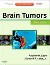 Brain Tumors, 3e **