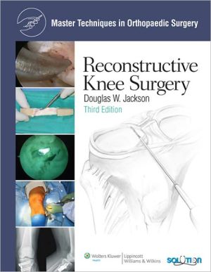 Reconstructive Knee Surgery: Master Techniques in Orthopaedic Surgery, 3e** | Douglas W. Jackson Reconstructive Knee Surgery: Master Techniques in Orthopaedic Surgery, 3e** | Douglas W. Jackson