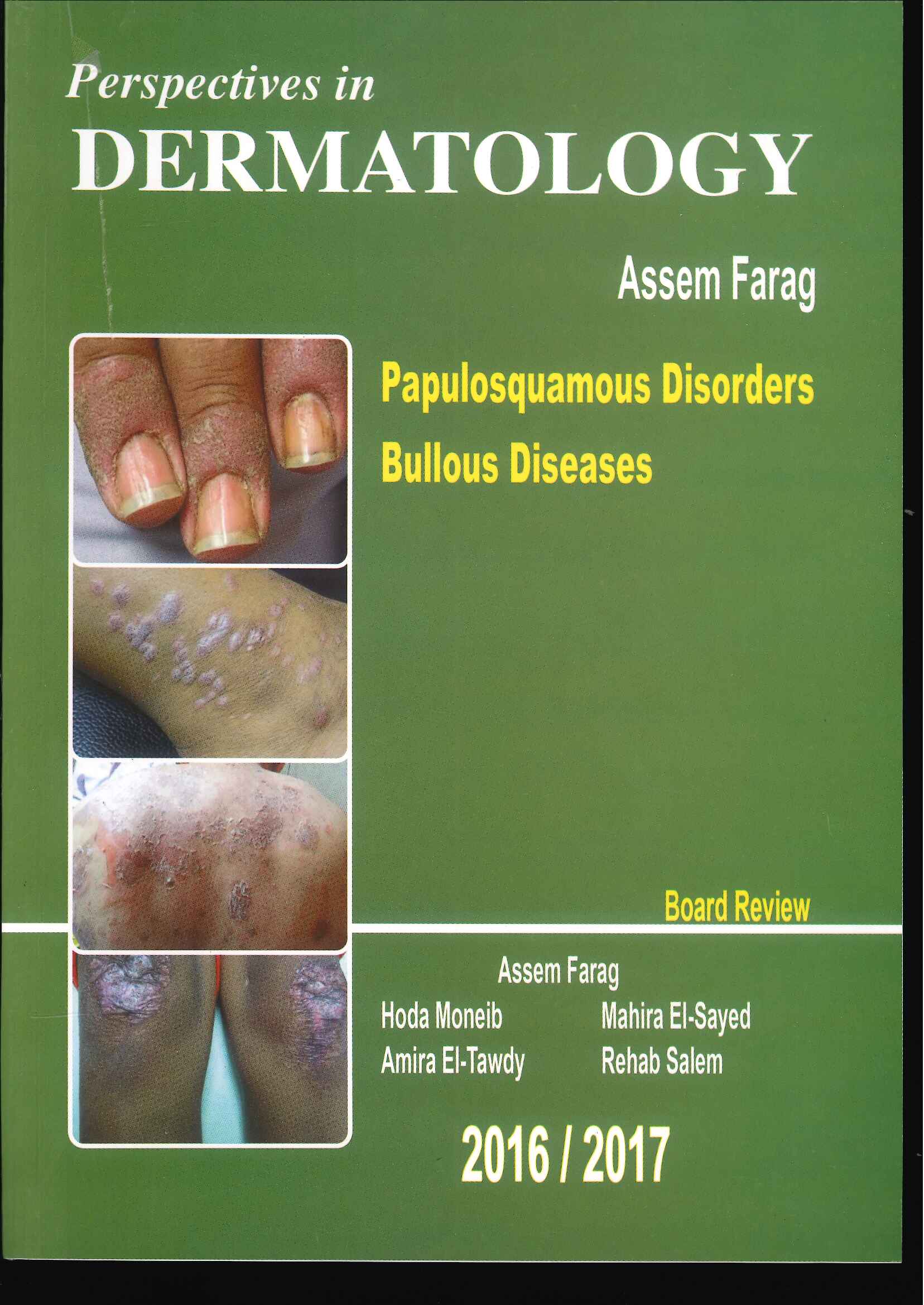 Perspectives in Dermatology : Papulosquamous Disorders , Bullous Diseases Perspectives in Dermatology : Papulosquamous Disorders , Bullous Diseases
