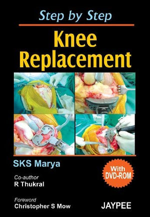 Step By Step Knee Replacement with DVD-ROM** | ABC Books